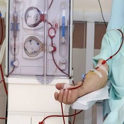 Introduction%20to%20dialysis.jpg