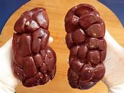 Kidney, lamb, raw